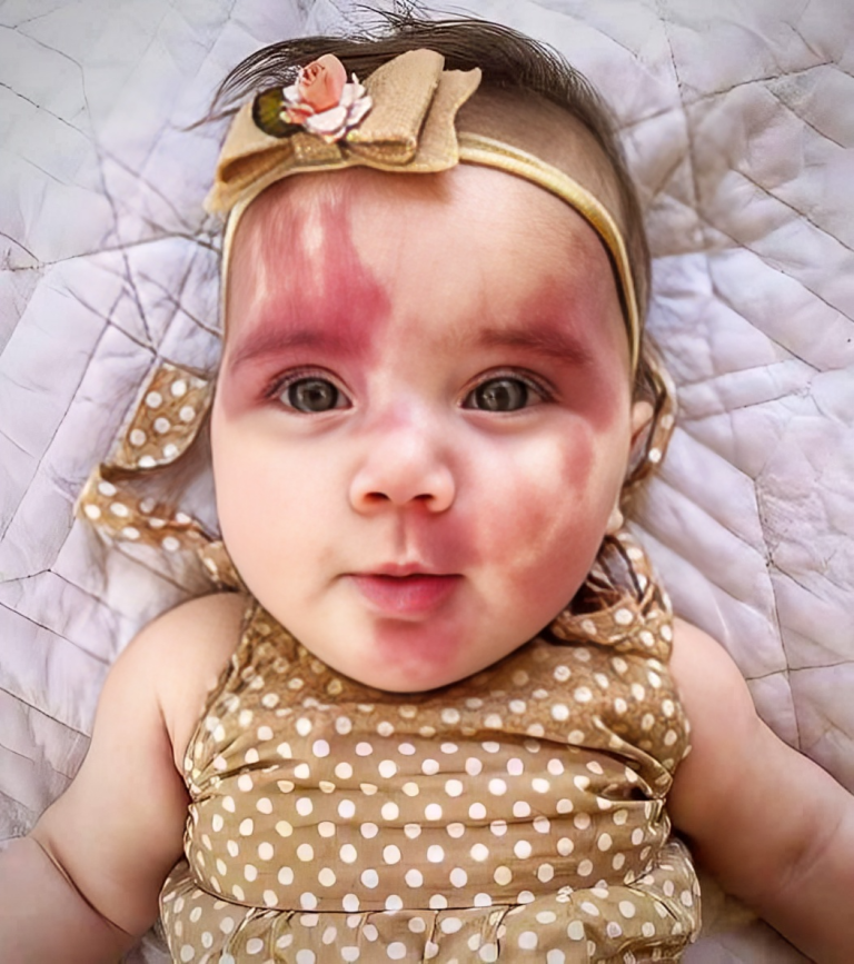 Baby Girl Called “Defective” Stuns With Her Beauty
