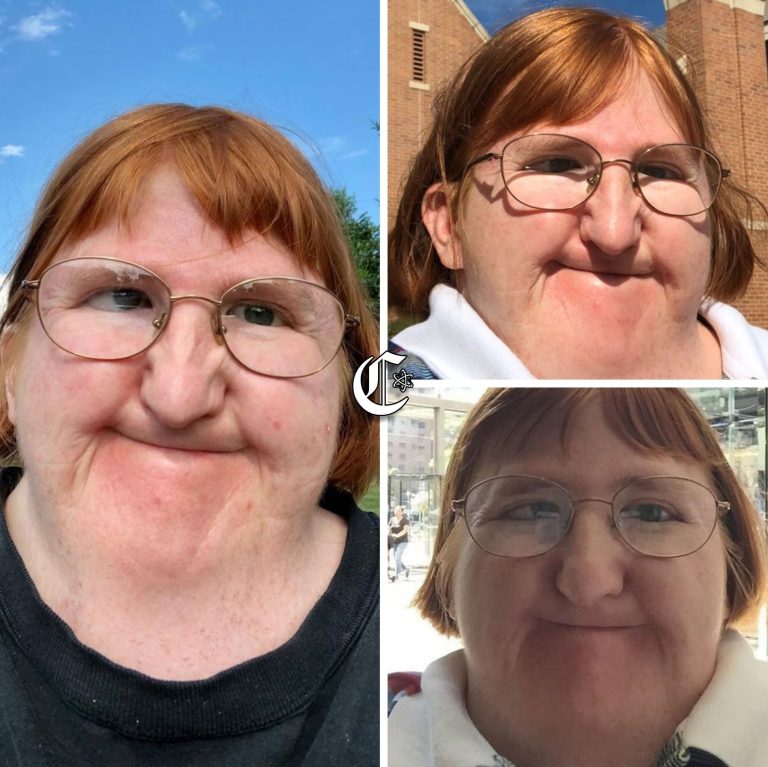 She didn’t hide. She showed the world her face — every day for a year!