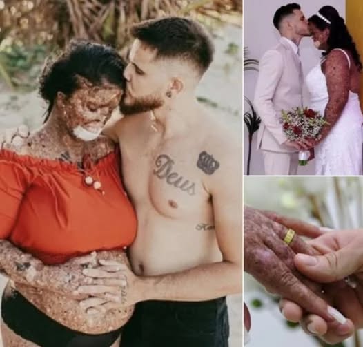 Man ignores trolls calling his girlfriend a ‘monster’ and ‘zombie’ – marries her & embraces her 3 kids as his own