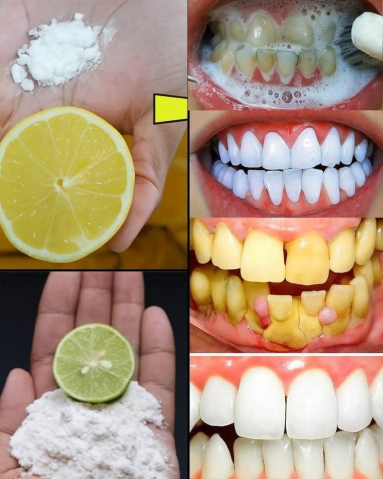 Discover the Hidden Sparkle: Transform Your Smile with the Baking Soda and Lemon Magic Duo! ✨