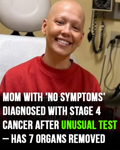 Mom with ‘no symptoms’ diagnosed with Stage 4 cancer after unusual test – has 7 organs removed